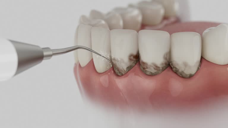 Trusted Teeth Cleaning And Checkup service in Brookshire, TX - Dentist Open Now